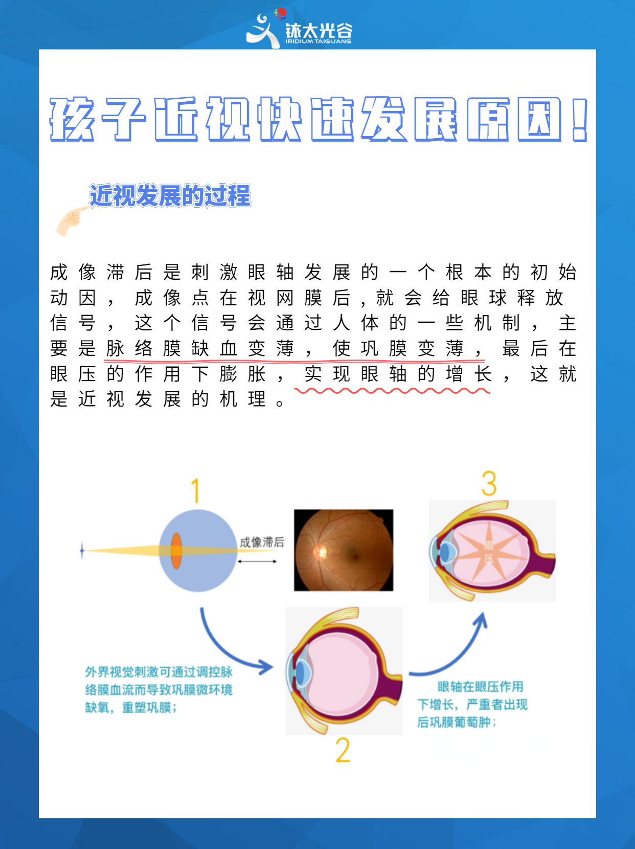 睫状肌是碳基生物体，不是机器。